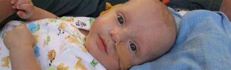 Retinoblastoma: Symptoms, Diagnosis And Treatment