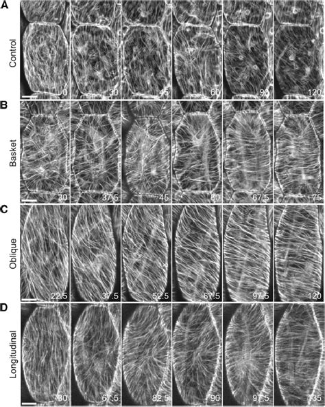 Cortical Microtubule Reorganization From Basket Oblique Or