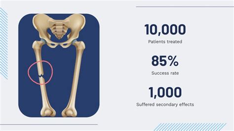 Femur Fracture Presentation