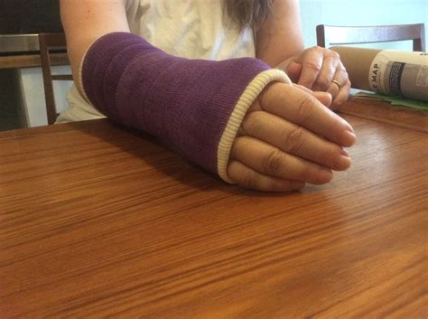 Royal Purple Lightweight Fibreglass Bandage Cast It Cast Arm Cast