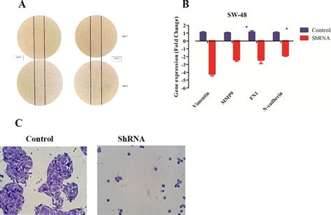 Downregulation Of LncRNA AC087388 1 Attenuates Cell Motility And