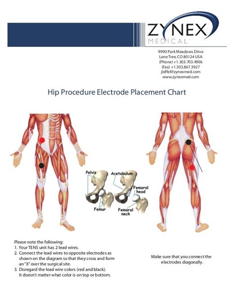 Tens Machine Pad Placement Chart Tens Electrode Placement Chart Pdf