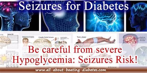 Diabetic seizures causes, symptoms, treatment