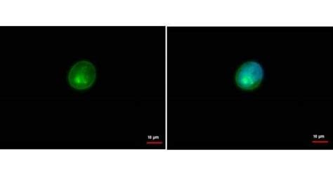 Hla Dra Polyclonal Antibody Invitrogen™ 100 μl Unconjugated Primary