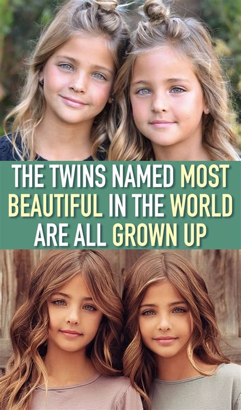 The Twins Named Most Beautiful In The World Are All Grown Up | Twin ...