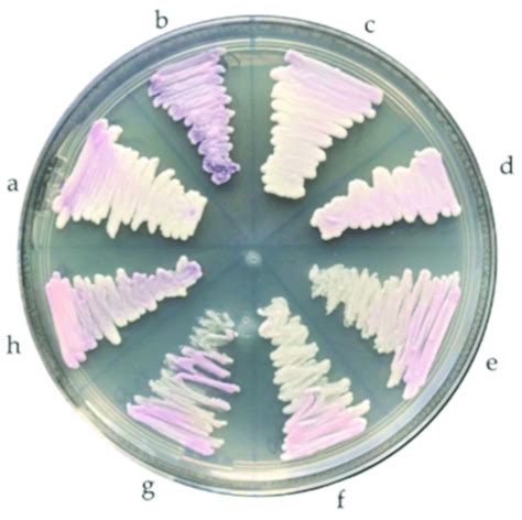 Phenotypic Characteristics Of Candida Haemulonii Complex Species Grown