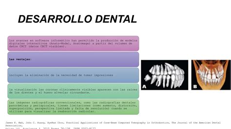 Tomografía Computarizada De Haz Cónico Cbct Pptx