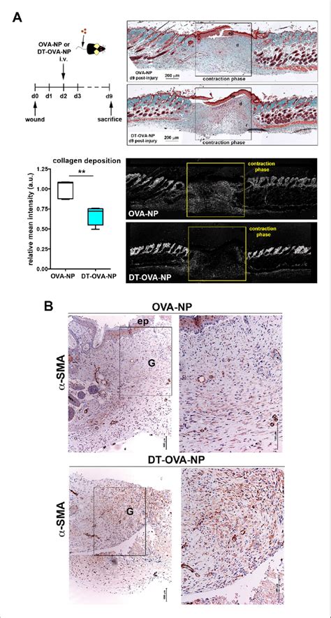 Macrophage Depletion Using Dt Ova Np Impaired Collagen Deposition And