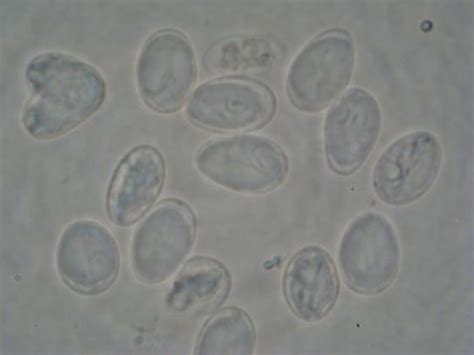 Giardia Lamblia Slide