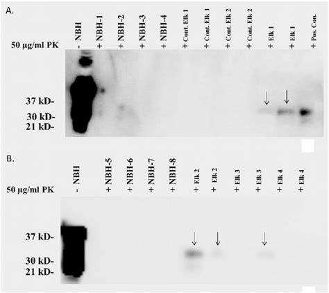 Figure From Detection Of Prion Protein In The Cerebrospinal Fluid Of