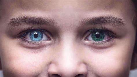 Heterochromia: What causes differently coloured eyes?