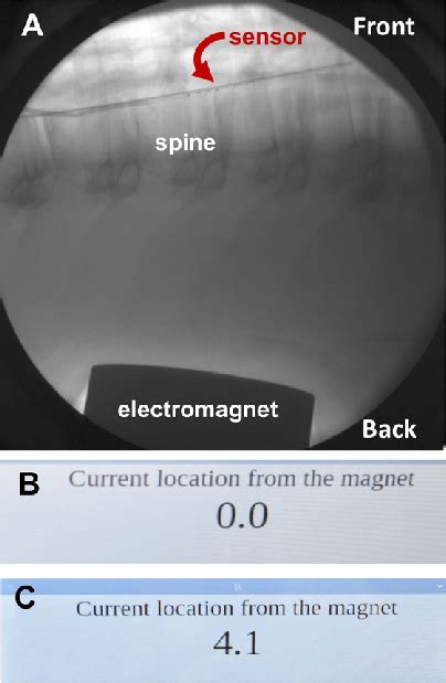 A Lateral Fluoroscopic View Of Sensor Demonstrating Electromagnet