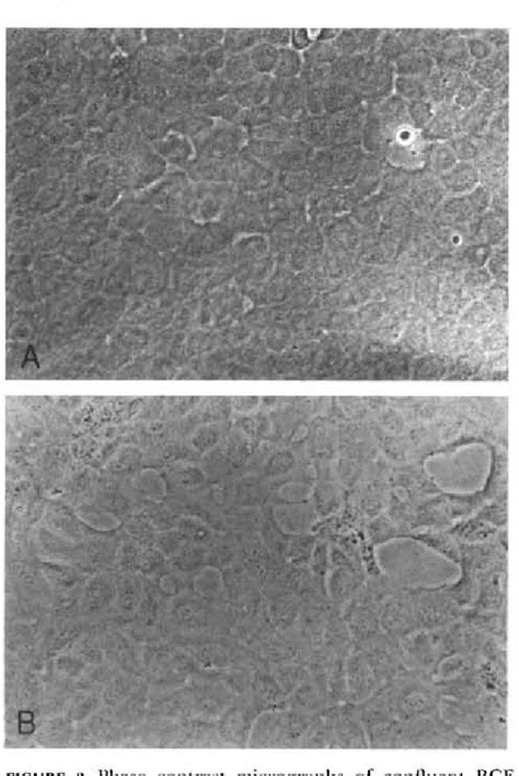 Figure From The Effect Of Thrombin On Actin Filament And Vinculin Of