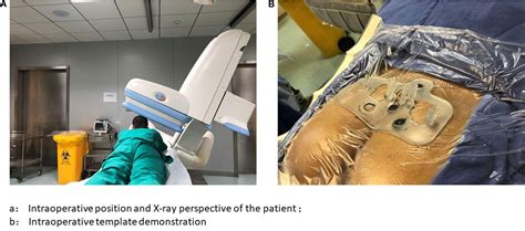 Frontiers Neuromodulation Of The Pudendal Nerve Assisted By D