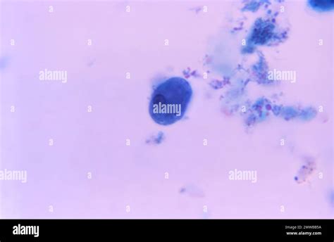 This Trichrome Stained Photomicrograph Showed An Amoebic Trophozoite Entamoeba Histolytica