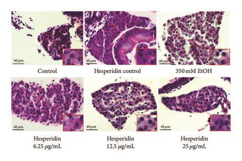 Hesperidin Reduced Hepatic Steatosis In Zebrafish Larvae Induced By