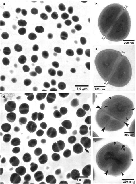 7 O Malonyl Macrolactin A A New Macrolactin Antibiotic From Bacillus