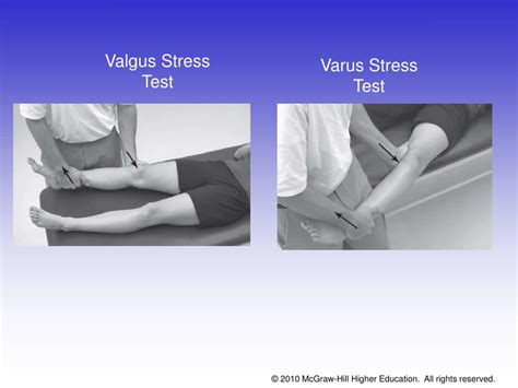 Ppt Chapter 16 The Knee And Related Structures Powerpoint Presentation Id436868