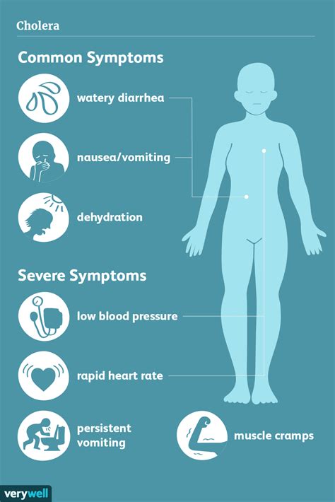 Cholera: Signs, Symptoms, and Complications