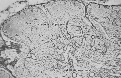 HLS [ Connective Tissue, reticular fibers] MED MAG labeled