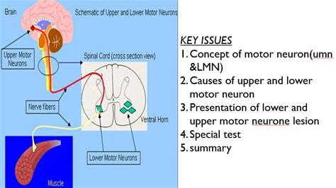 Upper And Lower Motor Neuron Lesions NoteXchange