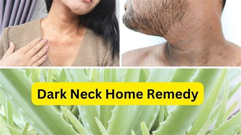 Dark Neck Removal How To Get Rid Of Dark Neck Diy Pigmentation