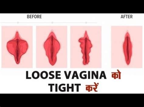 Vagina Ko Tight Kaise Kare Vagina Tight Karne Ka Tarika Vagina