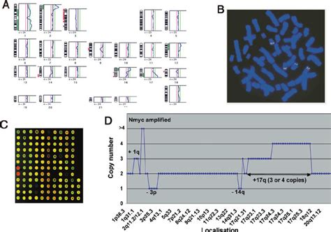 Agreement between results from array-CGH, conventional CGH and FISH... | Download Scientific Diagram