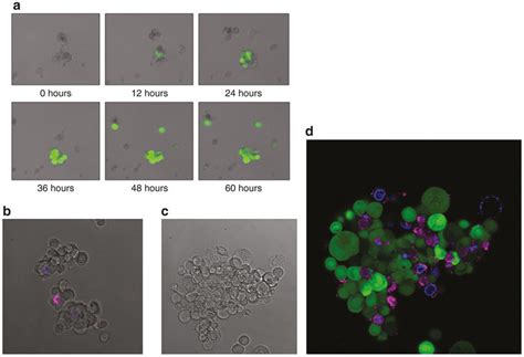 Fluorescence Microscopy Demonstrates Virus Induced Green Fluorescent