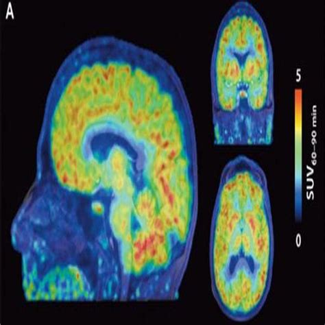 How Can We Improve Our Memory Brain Scan Neuroscience Brain Brain Age