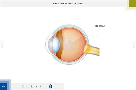 Distacco Retina Tipologie Sintomi Cause E Percorso Di Cure