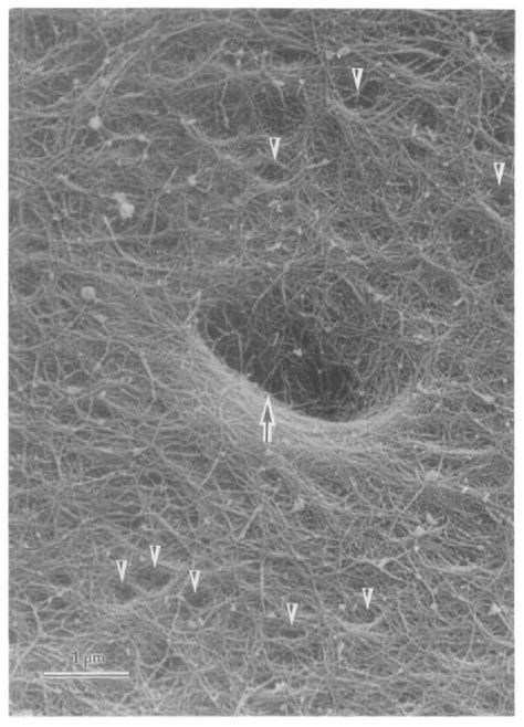 Figure 1 From The Three Dimensional Organization Of Collagen Fibrils In