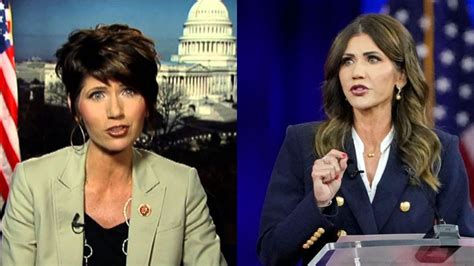 Kristi Noem Plastic Surgery Inside Her Plastic Surgery Procedures