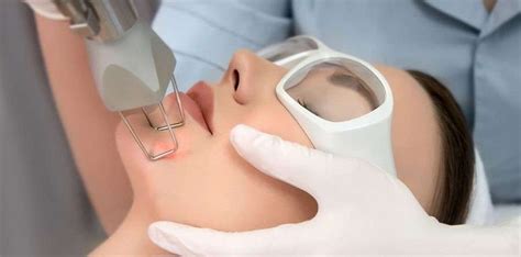 Indicaci N Laser Co Cl Nica Mediderma