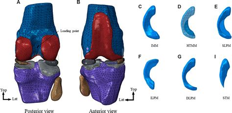 Frontiers Biomechanical Effects Of The Medial Meniscus Horizontal