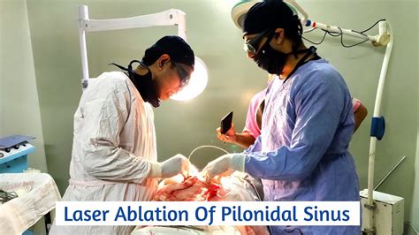 Laser Ablation Of Pilonidal Sinus Done By Shsmch Surgery Department Unit 5 Youtube