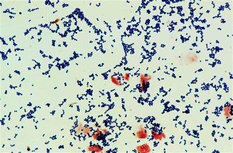 Staphylococcus Epidermidis Gram Stain