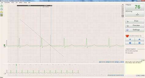 BTL CARDIOPOINT ECG C600 EKG Sorunuz KDV