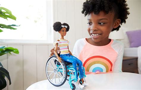 Barbie Celebrates Diversity By Creating Differently-Abled Dolls With Vitiligo And No Hair