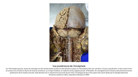 Médias Neuroanatomie Laboratoire d Anatomie Faculté de Médecine