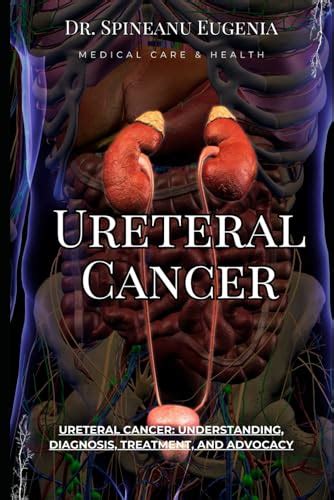 Ureteral Cancer Understanding Diagnosis Treatment And Advocacy By