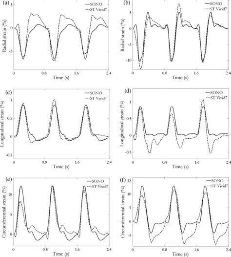 Strain Estimation Sample Curves Radial Strain Upper Plots