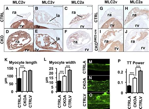 Atrial Identity Is Determined By A Coup Tfii Regulatory Network