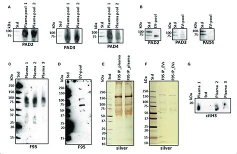 Peptidylarginine Deiminases PADs And Deiminated Proteins In