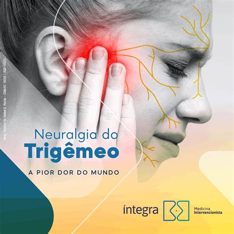 Como Aliviar A Dor Da Neuralgia Do Trigêmeo - Neuralgia do trigêmeo, a pior dor que existe - Dica Médica