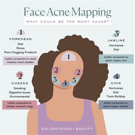 Face And Body Acne Mapping — Enlightened Beauty by Morgan Elizabeth