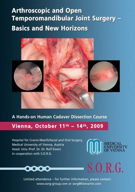 Arthroscopic And Open Temporomandibular Joint Surgery