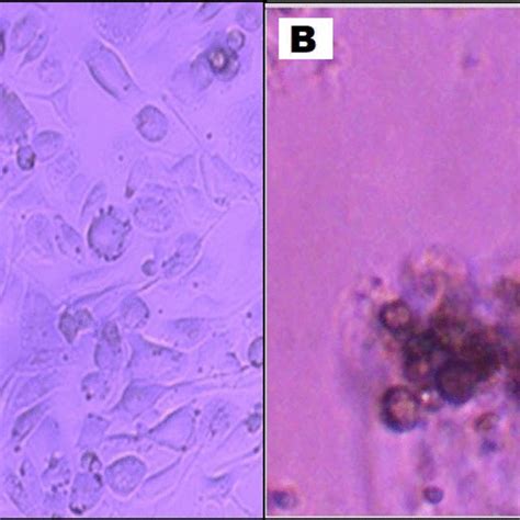 Inverted Microscope Image Of Human Mesenchymal Stem Cells Showing In A Download Scientific