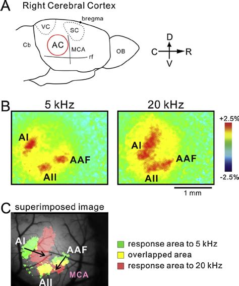 Flavoprotein Fluorescence Imaging Of The Mouse Auditory Cortex A