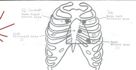 Echo Abnormal Heart Sounds And Murmurs Flashcards Quizlet